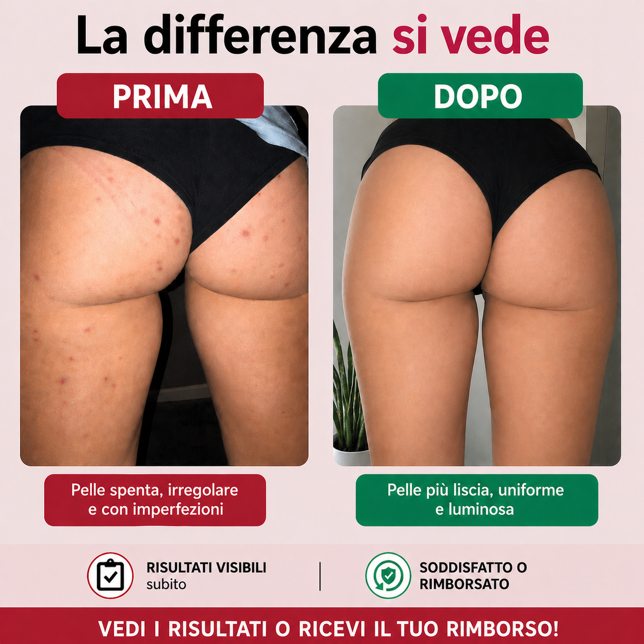 Zaelora™ — Spray Esfoliante Anti-Macchie