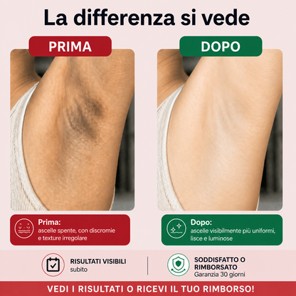 Zaelora™ — Spray Esfoliante Anti-Macchie